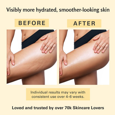 Anti-Cellulite Massage Oil